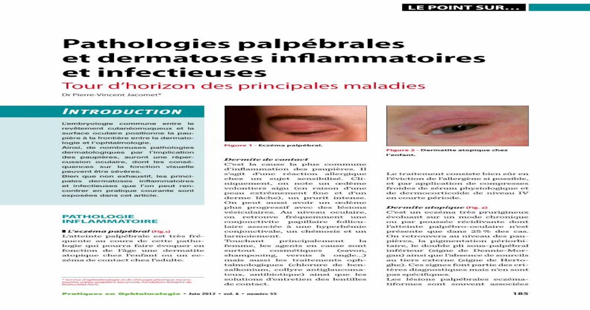 Pathologies Palpébrales Et Dermatoses Inflammatoires Et · Le Zona