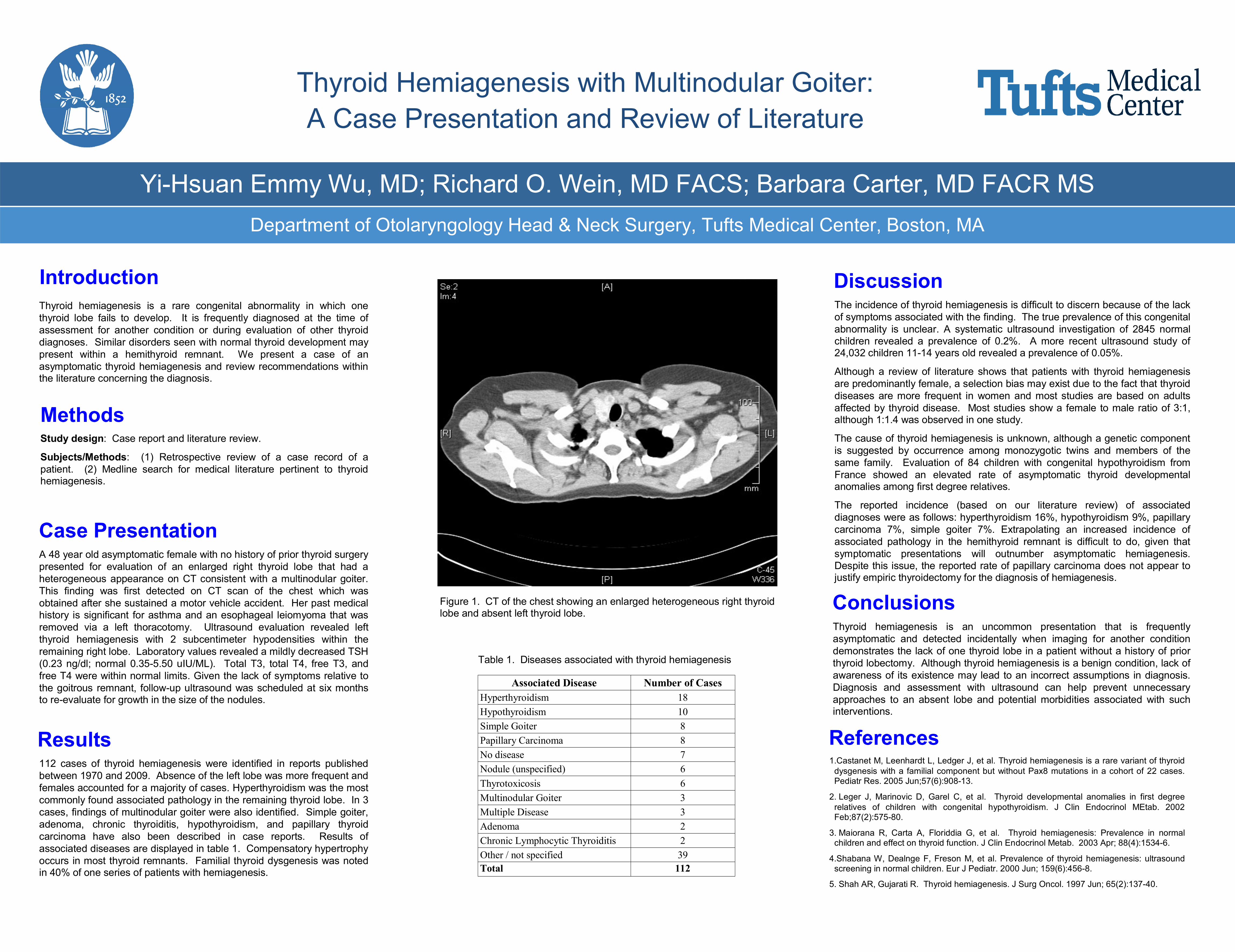 Thyroid Hemiagenesis With Multinodular Goiter A Case Presentation And